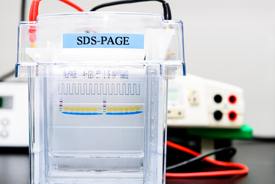 Layanan analisa elektroforesis protein SDS PAGE